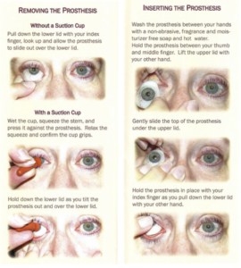 Complete Haptic Shell Frequently Asked Questions | Artificial Eyes Australia